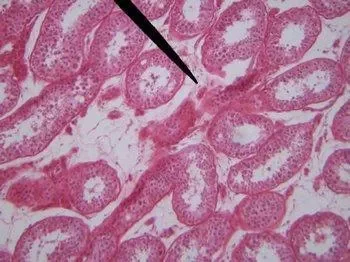 Human Testis